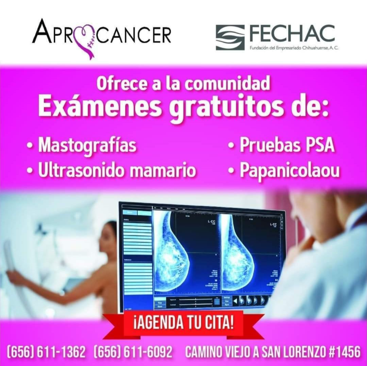 campana de donacion de cabello